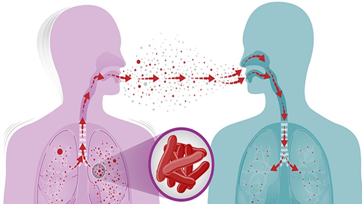 India TB Report - 2024